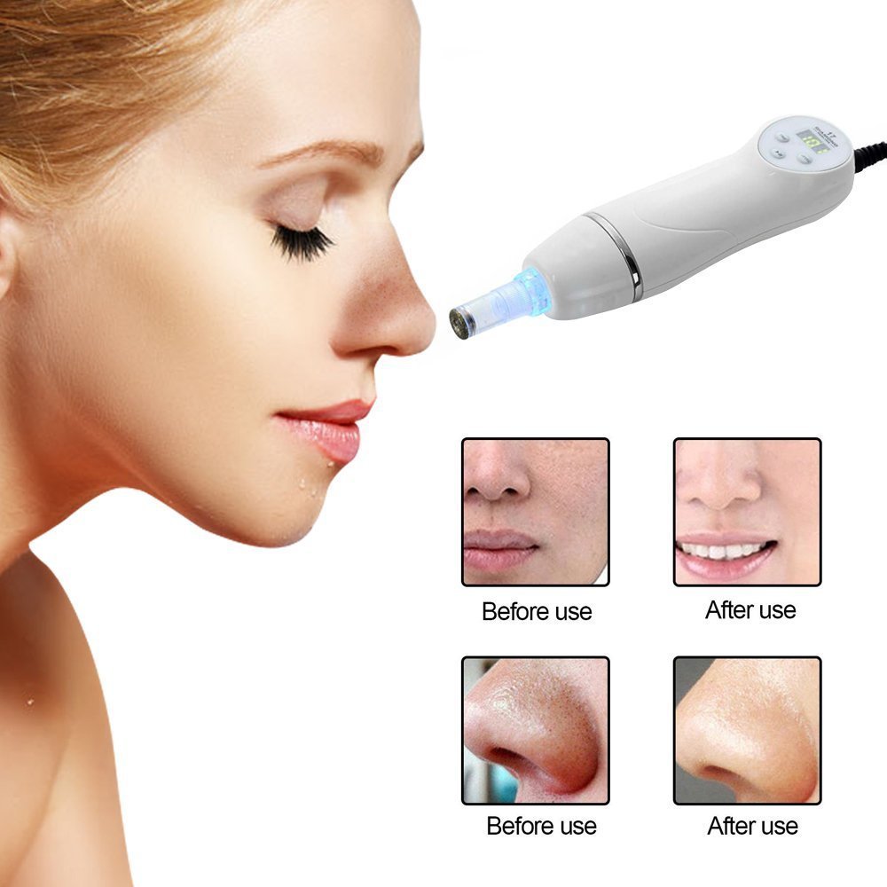 Clean Pore Cleaner Electric Blackhead Remover